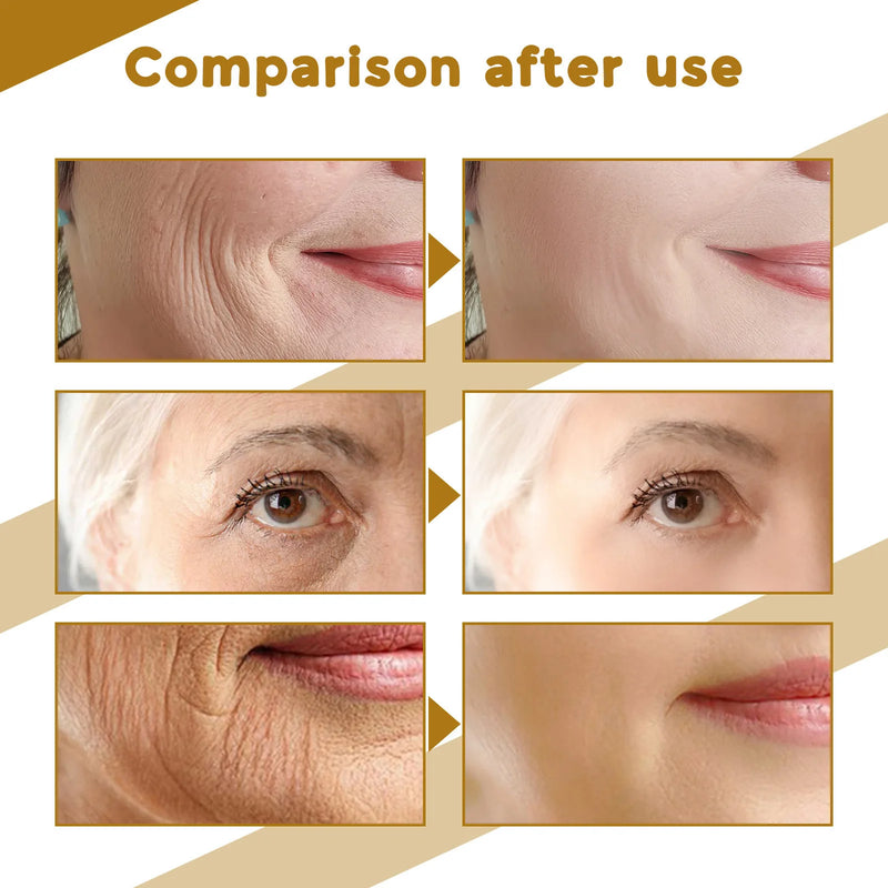 Suero Facial rejuvenecedor