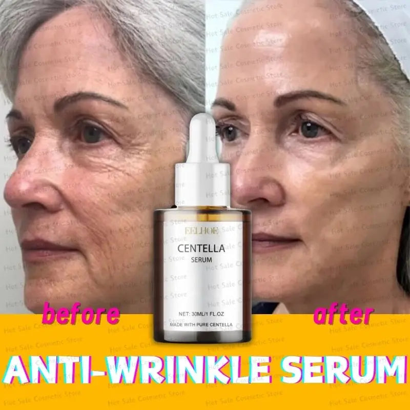 Suero Facial rejuvenecedor