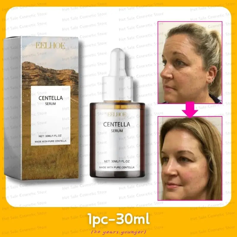 Suero Facial rejuvenecedor